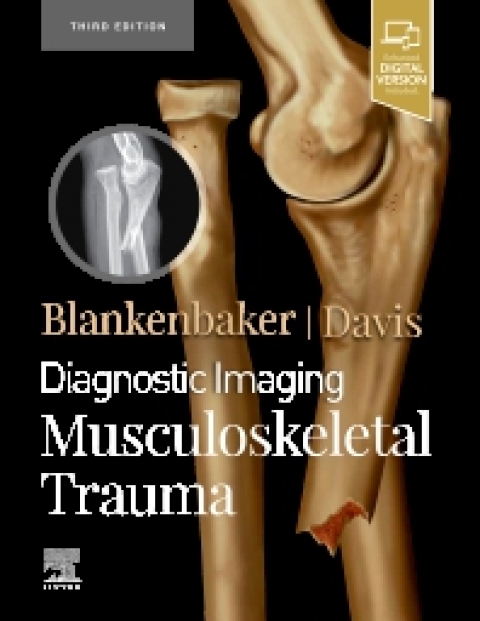 Diagnostic Imaging: Musculoskeletal Trauma 