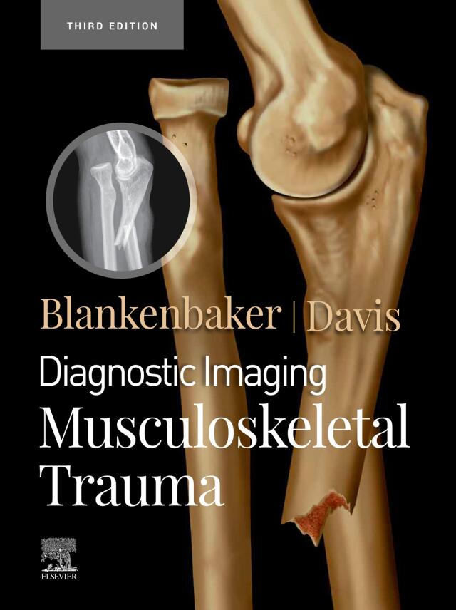 Diagnostic Imaging: Musculoskeletal Trauma