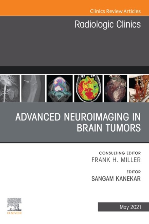 Cover image for book Advanced Neuroimaging in Brain Tumors, An Issue of Radiologic Clinics of North America