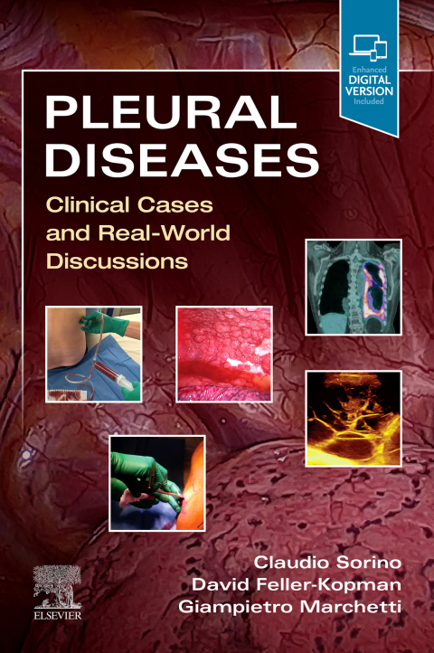 Cover image for book Pleural Diseases