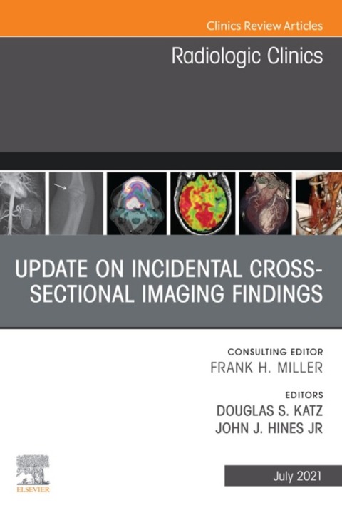 Cover image for book Update on Incidental Cross-sectional Imaging Findings, An Issue of Radiologic Clinics of North America