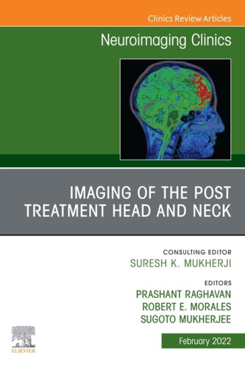 Cover image for book Imaging of the Post Treatment Head and Neck, An Issue of Neuroimaging Clinics of North America