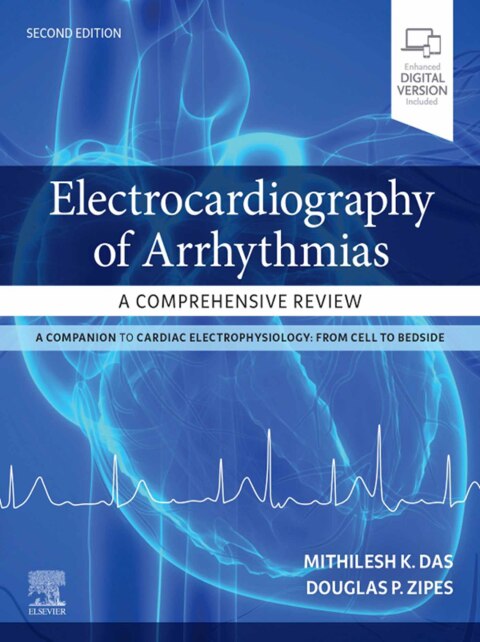 Electrocardiography of Arrhythmias: A Comprehensive Review 