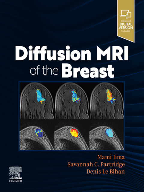 Cover image for book DIFFUSION MRI OF THE BREAST