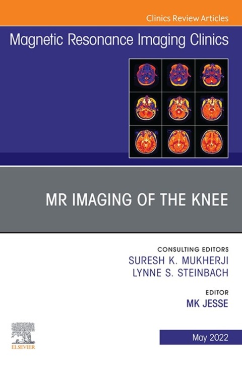 Cover image for book MR Imaging of The Knee, An Issue of Magnetic Resonance Imaging Clinics of North America