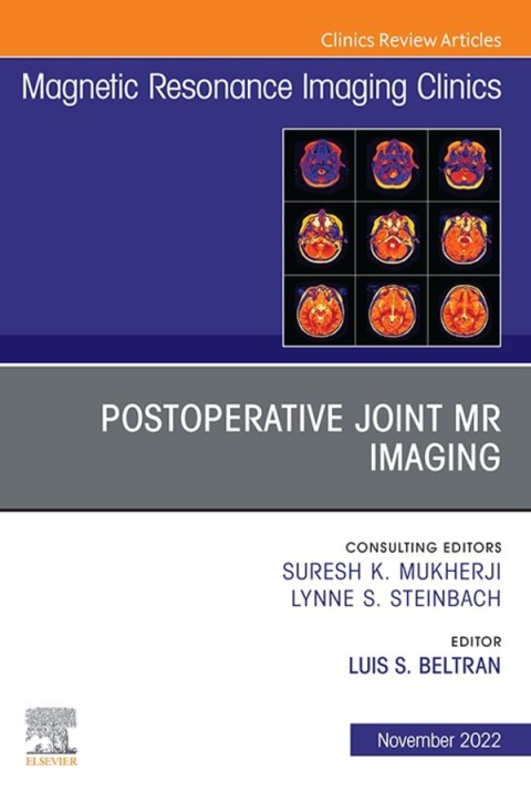 Cover image for book Postoperative Joint MR Imaging, An Issue of Magnetic Resonance Imaging Clinics of North America