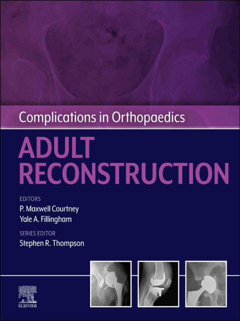 Cover image for book Complications in Orthopaedics: Adult Reconstruction - E-Book