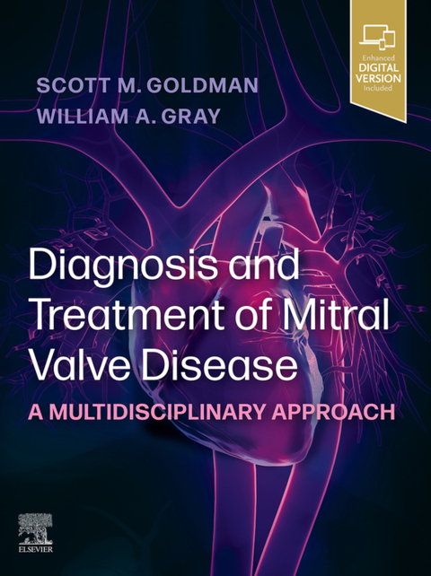 Cover image for book Diagnosis and Treatment of Mitral Valve Disease
