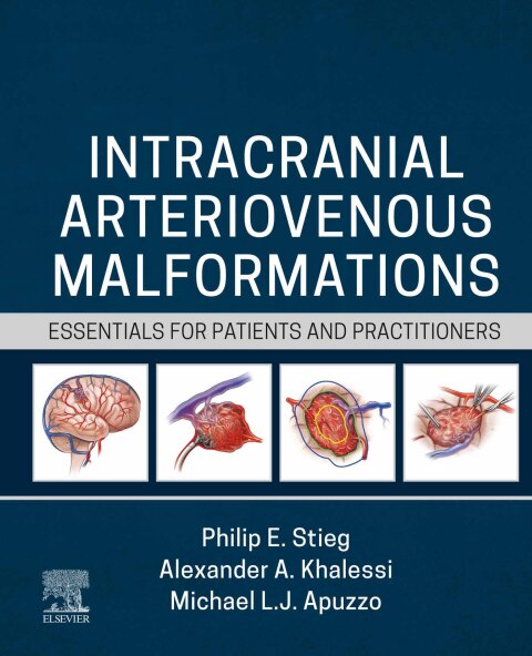Cover image for book Intracranial Arteriovenous Malformations