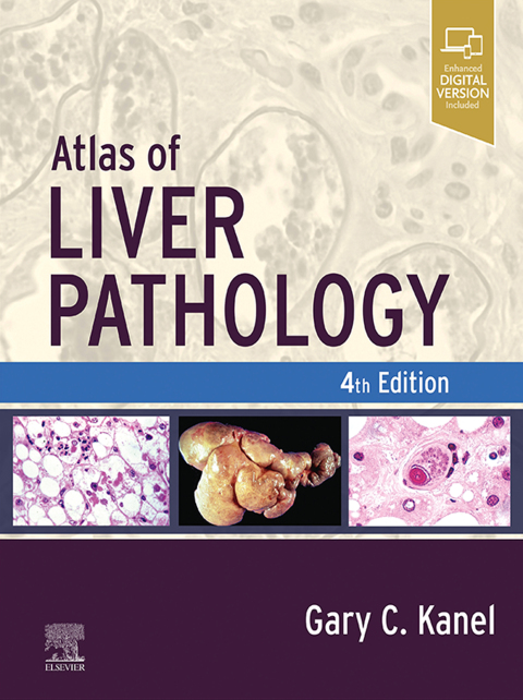Cover image for book Atlas of Liver Pathology