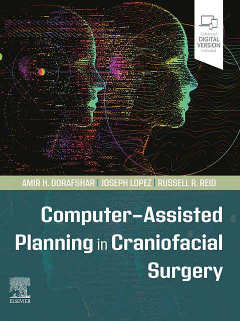 Cover image for book Computer-Assisted Planning in Craniofacial Surgery