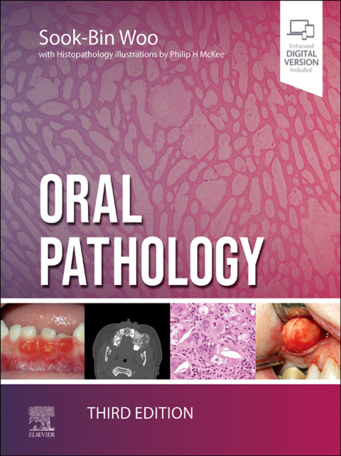 Cover image for book Oral Pathology