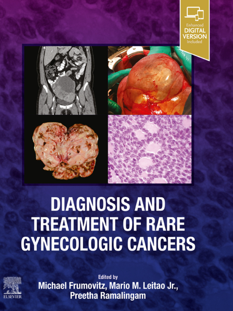 Cover image for book Diagnosis and Treatment of Rare Gynecologic Cancers