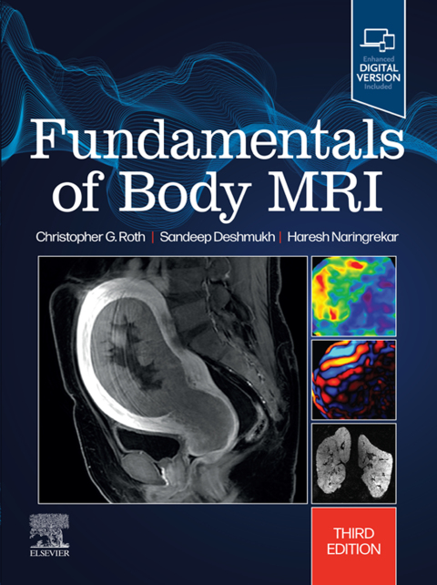 Cover image for book Fundamentals of Body MRI