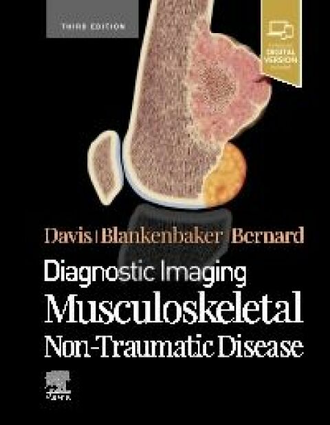 Diagnostic Imaging: Musculoskeletal Non-Traumatic Disease - E-Book 