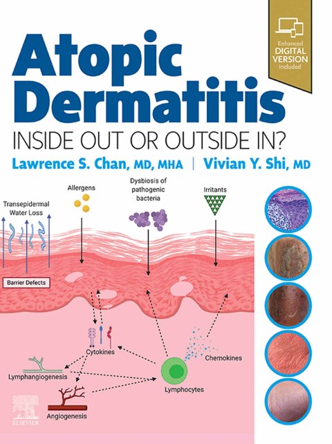 Cover image for book Atopic Dermatitis: Inside Out or Outside In