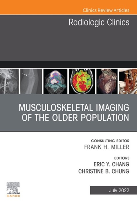 Cover image for book Musculoskeletal Imaging of the Older Population, An Issue of Radiologic Clinics of North America, E-Book