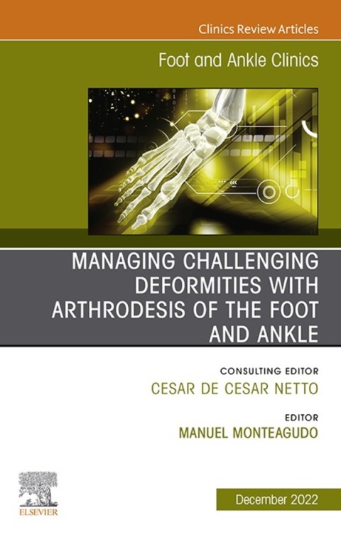 Cover image for book Managing Challenging deformities with arthrodesis of the foot and ankle, An issue of Foot and Ankle Clinics of North America