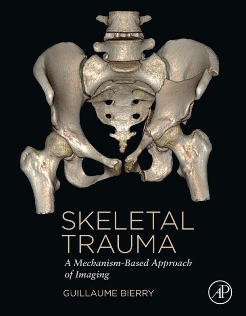 Cover image for book Skeletal Trauma