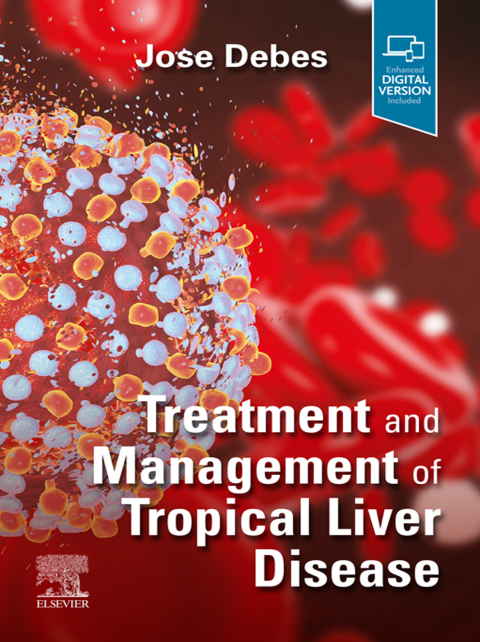 Cover image for book Treatment and Management of Tropical Liver Disease