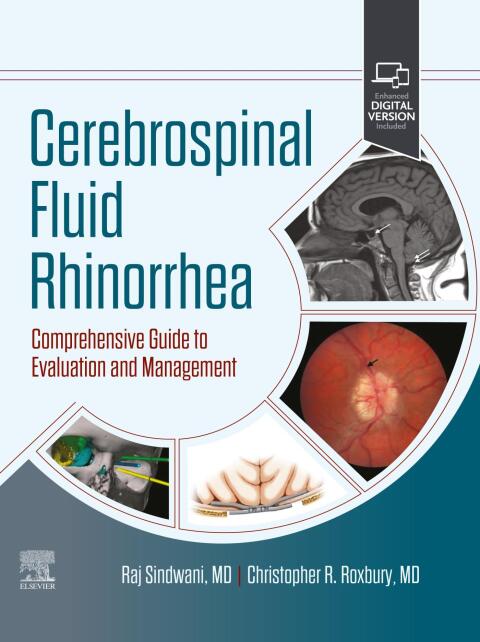Cover image for book Cerebrospinal Fluid Rhinorrhea