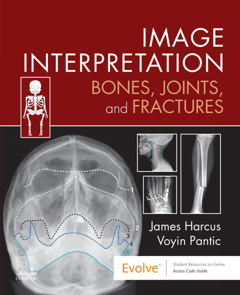Cover image for book Image Interpretation: Bones, Joints, and Fractures