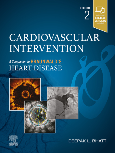 Cover image for book Cardiovascular Intervention