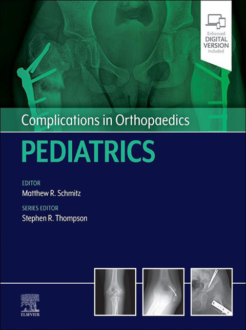 Cover image for book Complications in Orthopaedics: Pediatrics