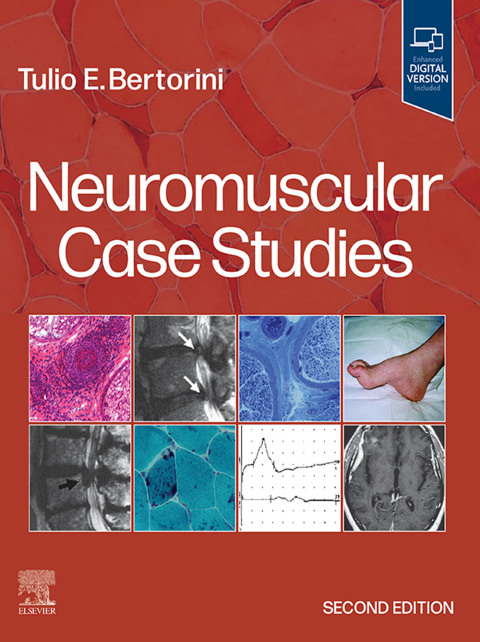 Cover image for book Neuromuscular Case Studies