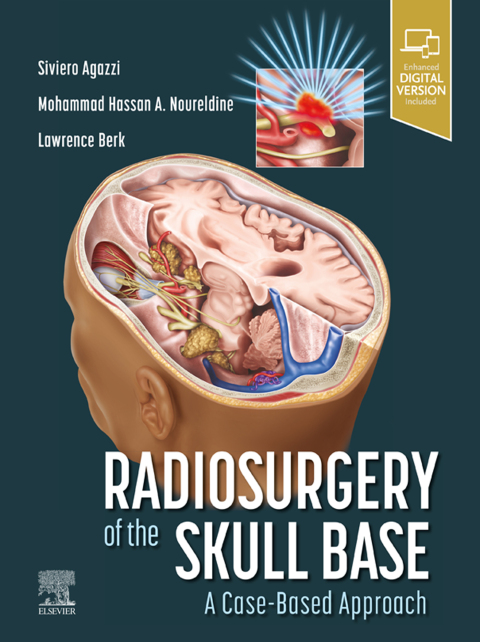 Cover image for book Radiosurgery of the Skull Base: A Case-Based Approach