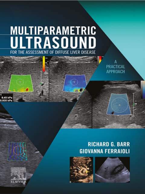 Cover image for book Multiparametric Ultrasound for the Assessment of Diffuse Liver Disease