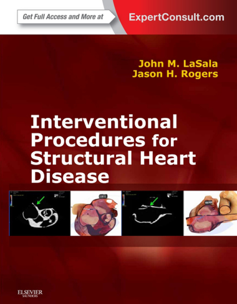 Cover image for book Interventional Procedures for Adult Structural Heart Disease