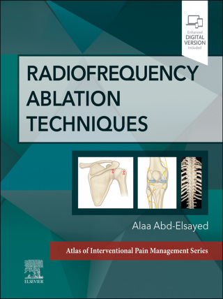 Radiofrequency Ablation Techniques