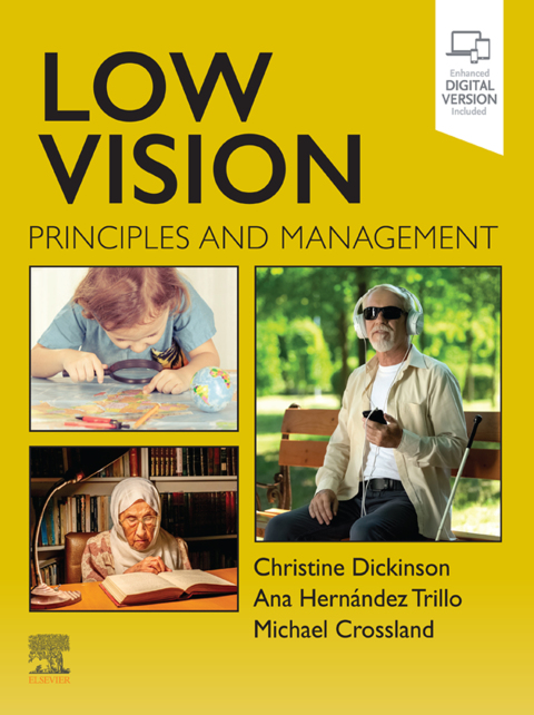 Cover image for book Low Vision
