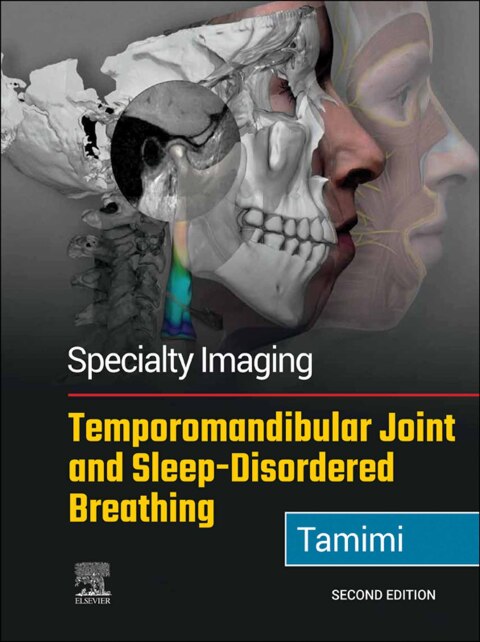 Cover image for book Specialty Imaging: Temporomandibular Joint and Sleep-Disordered Breathing