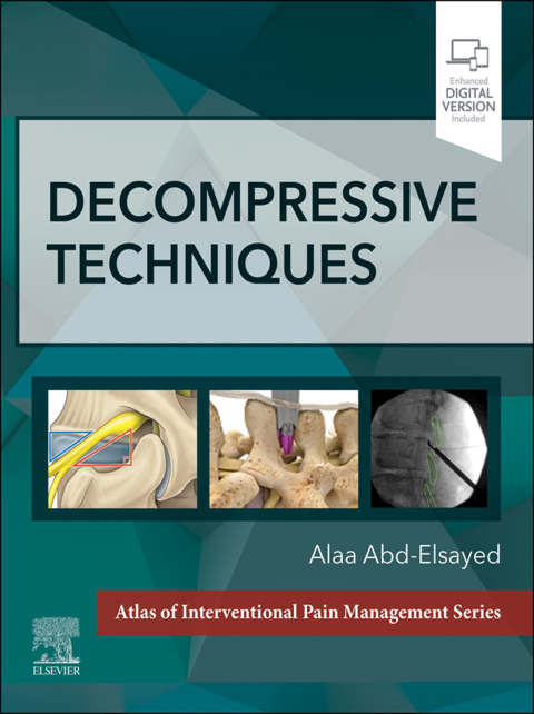 Cover image for book Decompressive Techniques