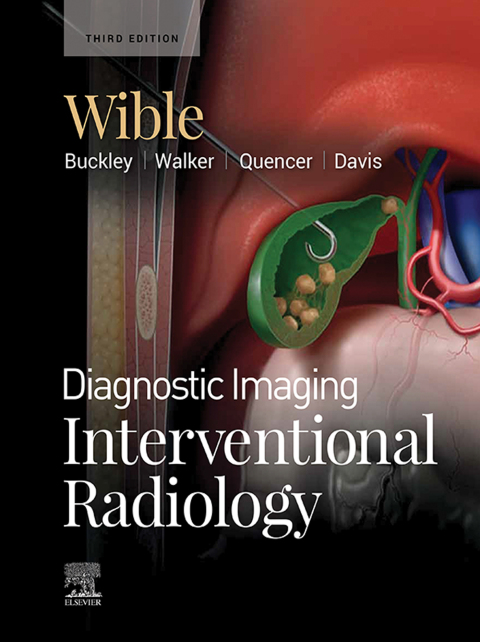 Cover image for book Diagnostic Imaging: Interventional Radiology E-Book