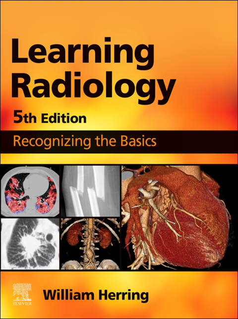 Cover image for book Learning Radiology E-Book
