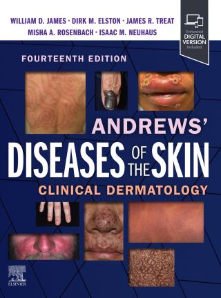Andrews' Diseases of the Skin
