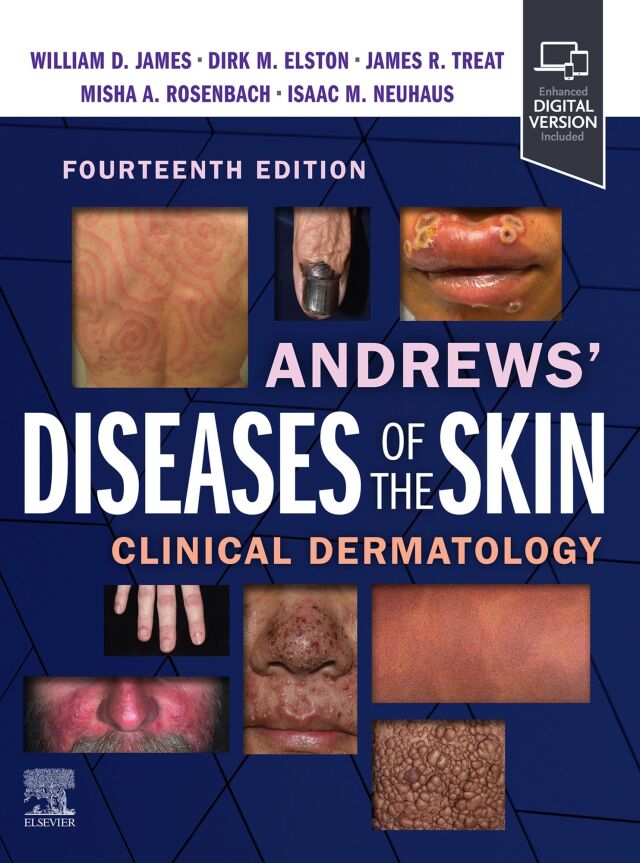 Andrews' Diseases of the Skin
