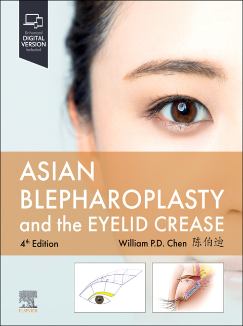 Cover image for book Asian Blepharoplasty and the Eyelid Crease