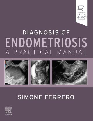 Endometriosis