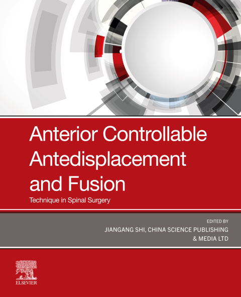 Cover image for book Anterior Controllable Antedisplacement and Fusion (ACAF)