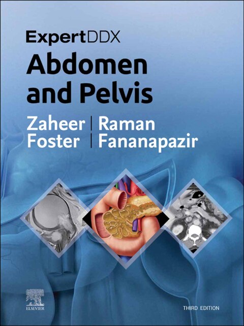 Cover image for book ExpertDDx: Abdomen and Pelvis