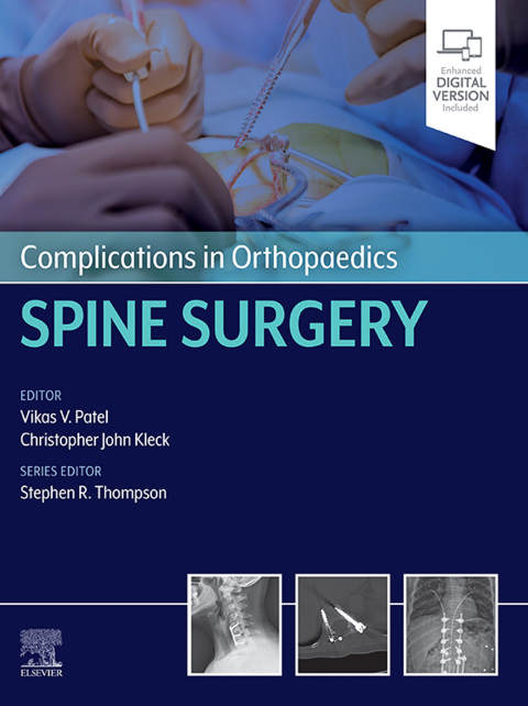 Complications in Orthopaedics: Spine Surgery 