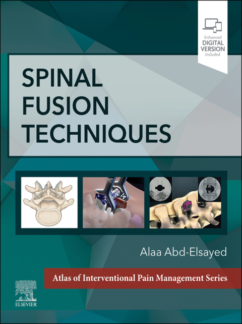 Cover image for book Spinal Fusion Techniques