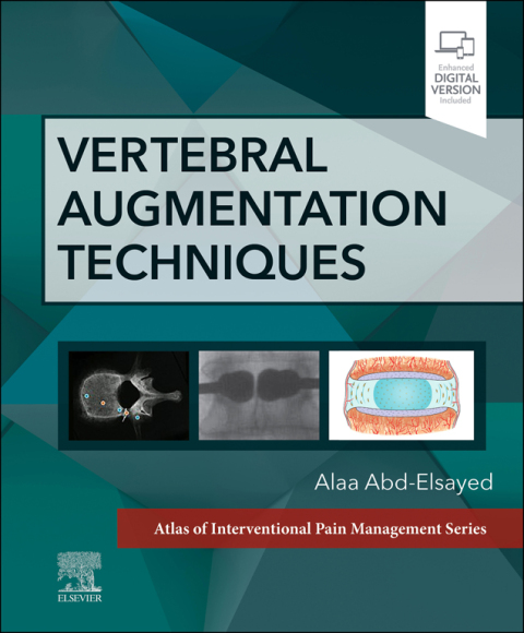 Cover image for book Vertebral Augmentation Techniques