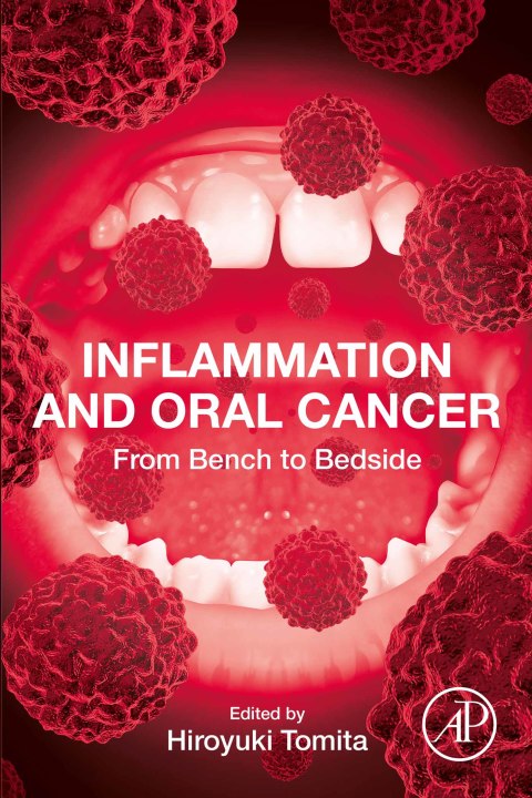 Cover image for book Inflammation and Oral Cancer