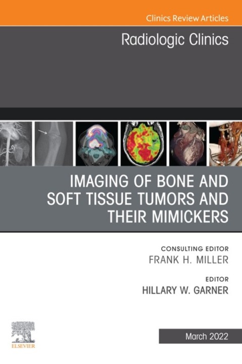 Cover image for book Imaging of Bone and Soft Tissue Tumors and Their Mimickers, An Issue of Radiologic Clinics of North America