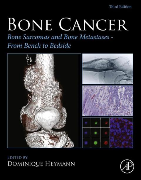 Cover image for book Bone Cancer